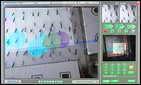 ARTAS Robotic FUE Imaging System