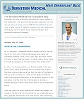 Hair Transplant Blog