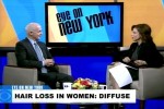 CBS Features Dr. Bernstein In Segment On Hair Transplants, Hair Loss