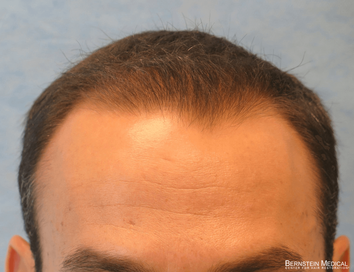medical hair restoration clinic