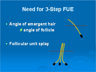 New Instrumentation for 3-step Follicular Unit Extraction - The anatomic features of the follicular unit that make blunt dissection important