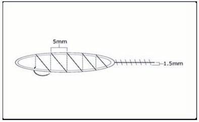 Figure 29.10 - Schematic of the suturing technique