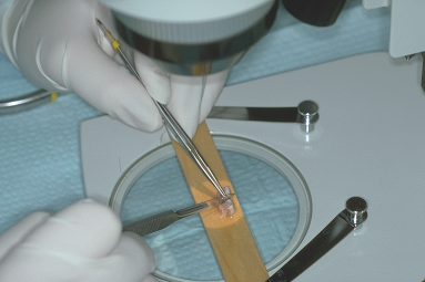 Figure 29.14 - Stereomicroscopic dissection of one section into smaller pieces