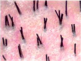 Figure 29.2 - Natural hair groupings