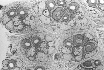 Figure 29.3 - Histological view of follicular units