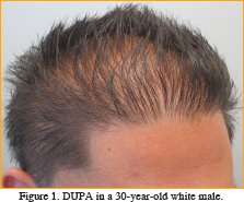 Age & Hair Transplant Donor Zone (2013)