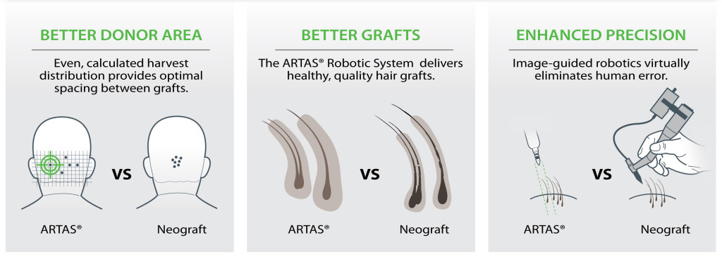 Neograft vs. ARTAS Robotic System