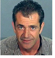 Celebrity Hair Transplants - Mel Gibson