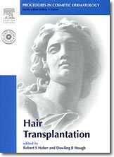 Procedures in Cosmetic Dermatology: Hair Transplantation - Elsevier Saunders