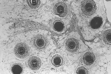 Follicular Family Unit - Scalp shown in a horizontal plane