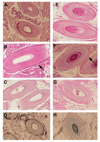 Follicular Unit Extraction - Hematoxylin-eosin staining of scalp biopsies of 6 different patients