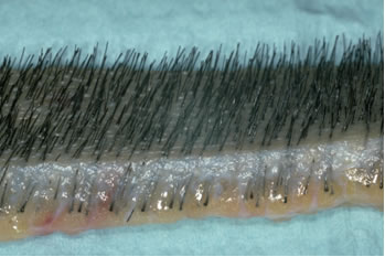 Follicular Unit Hair Transplantation - Close-up view of a donor strip showing the natural hair groupings at the surface