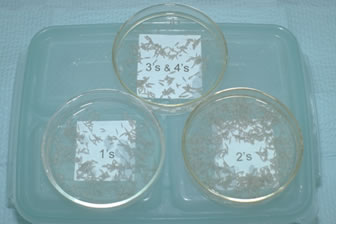 Follicular Unit Hair Transplantation - Petri dishes with one- to four-hair follicular units immersed in Ringer's lactate