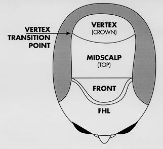 Follicular Unit Transplantation - Densitometry showing discrete natural groups as the hair emerges from the scalp