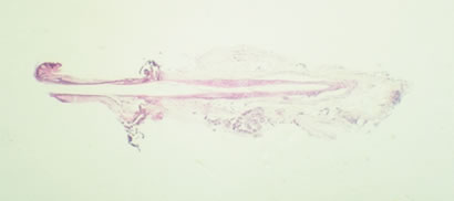 Graft Anchoring in Hair Transplantation - Day 2: Entire follicle present – Interpretation: Positive