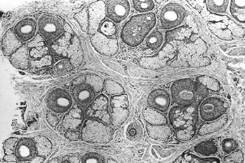 Logic of Follicular Unit Transplantation - Transverse histologic section of adult male scalp