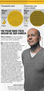 Dr. Bernstein, ARTAS Robot for FUE in Brazil's Veja Magazine