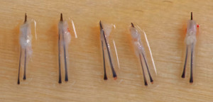 Robotically Harvested 2-Hair Follicular Unit Grafts