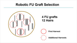 New Method: Selection by Graft Size