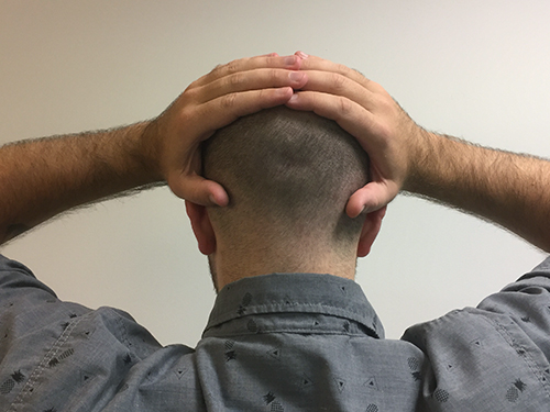 Scalp Laxity Exercise Position 3