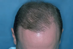Growth after One Repair Session