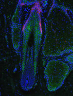 Miniaturized human hair follicle shows concentration of Prostaglandin D2 (in green). Credit: Garza and Cotsarelis/Penn Medicine)
