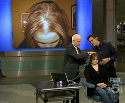 Dr. Bernstein, Dr. Oz Discuss Women's Hair Loss 'Taboo'