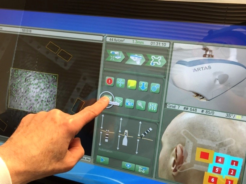 Fig 1. Touchscreen user interface - What's New in Robotic Hair Transplantation