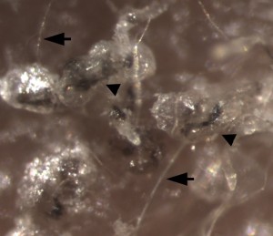 Figure 5 - Generation of folliculogenic human epithelial stem cells from induced pluripotent stem cells