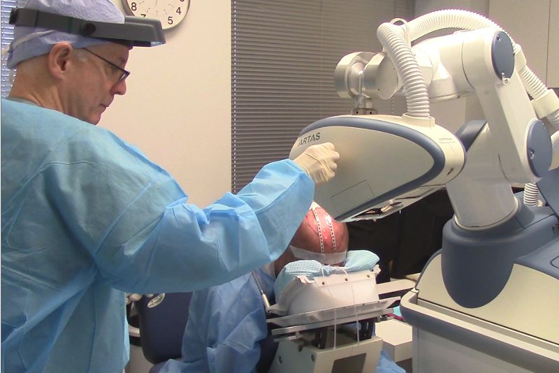 ARTAS System Recipient Site Creation in Robotic Hair Transplant Demonstrated at Bernstein Medical