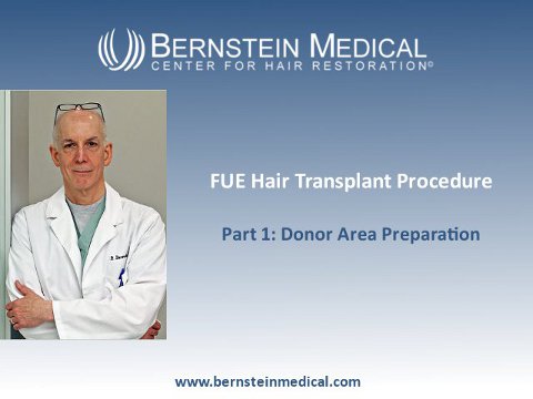 Robotic FUE Hair Transplant Procedure Part 1: Donor Area Preparation