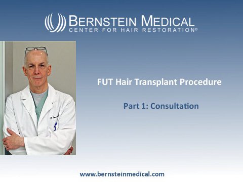 FUT Hair Transplant Procedure Part 1: Consultation