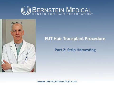 FUT Hair Transplant Procedure Part 2: Strip Harvesting