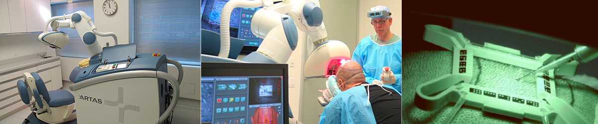 Robotic Hair Transplant